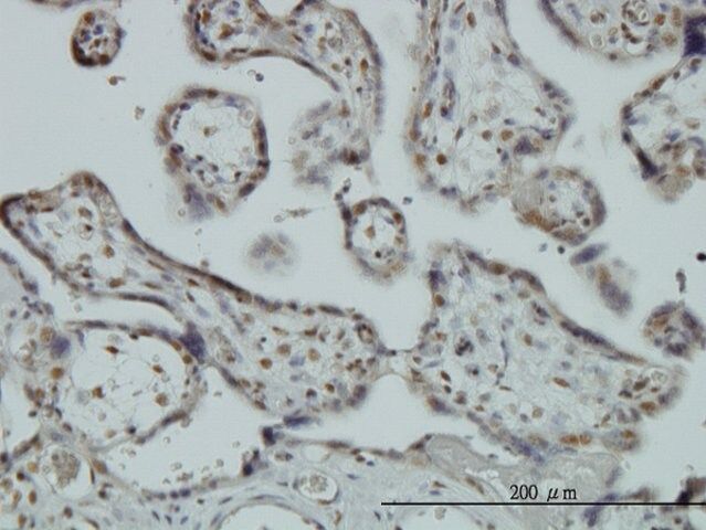 Monoclonal Anti-RBM9 antibody produced in mouse