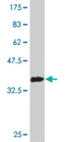 Monoclonal Anti-RBP3 antibody produced in mouse