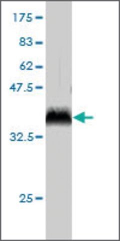 Monoclonal Anti-RCHY1 antibody produced in mouse