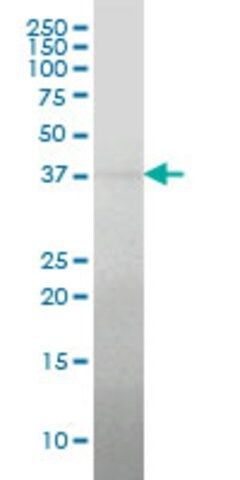 Monoclonal Anti-RCN2 antibody produced in mouse