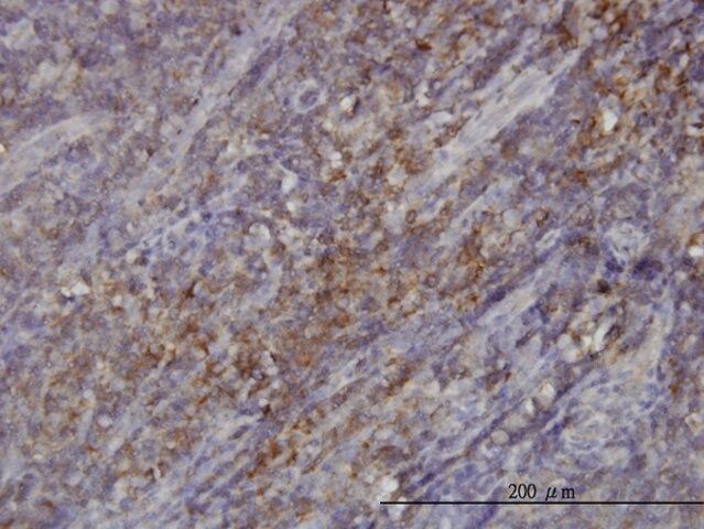 Monoclonal Anti-RASGRP4 antibody produced in mouse