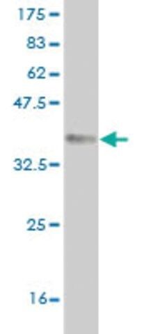 Monoclonal Anti-QPCT antibody produced in mouse