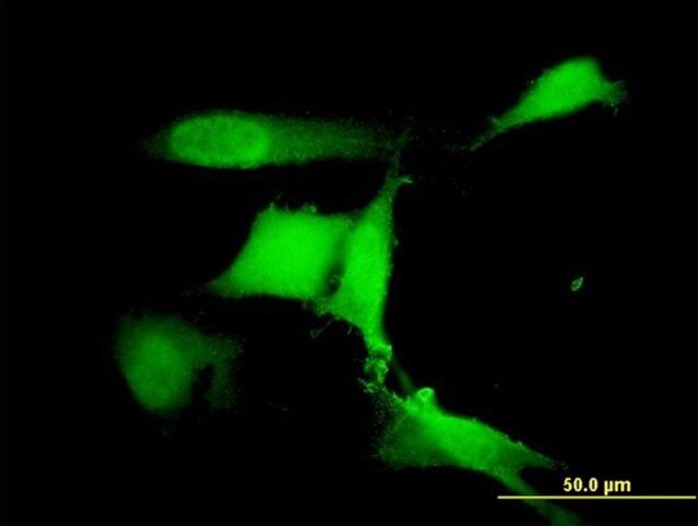 Monoclonal Anti-RFWD2 antibody produced in mouse