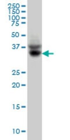 Monoclonal Anti-SLC35A3 antibody produced in mouse