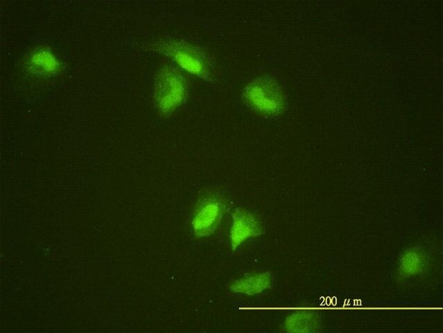 Monoclonal Anti-SLBP antibody produced in mouse