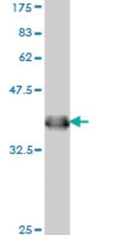 Monoclonal Anti-IFNAR1 antibody produced in mouse