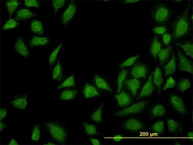 Monoclonal Anti-MTAP antibody produced in mouse