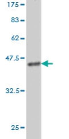 Monoclonal Anti-MS4A1 antibody produced in mouse