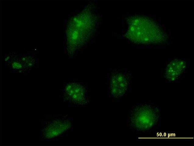 Monoclonal Anti-NCOA6 antibody produced in mouse