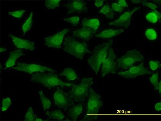 Monoclonal Anti-NDE1 antibody produced in mouse