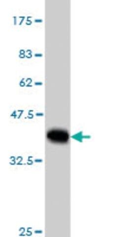 Monoclonal Anti-MYBPC1 antibody produced in mouse