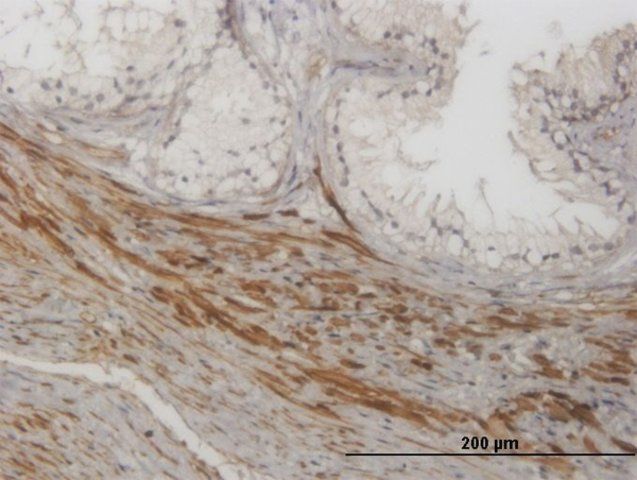 Monoclonal Anti-NKIRAS1 antibody produced in mouse