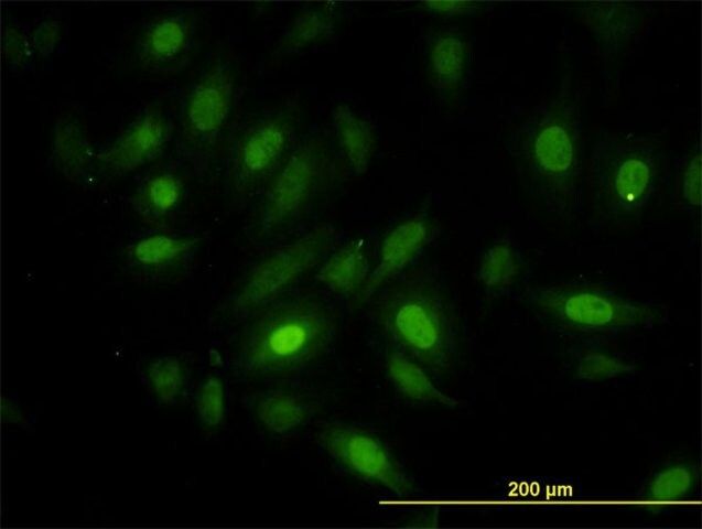 Monoclonal Anti-NEK10 antibody produced in mouse