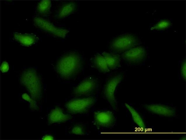 Monoclonal Anti-NUDC antibody produced in mouse