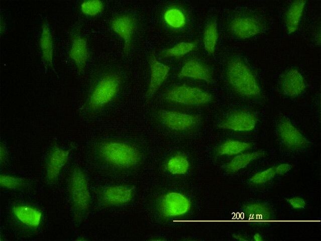 Monoclonal Anti-NPEPL1 antibody produced in mouse