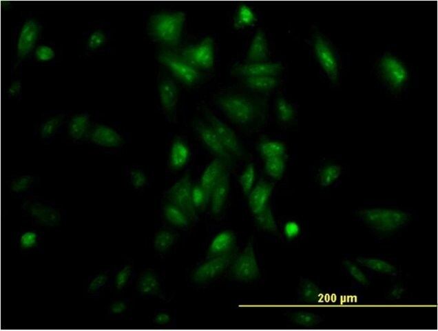 Monoclonal Anti-NR1H4 antibody produced in mouse