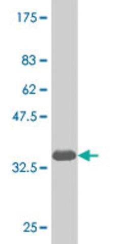 Monoclonal Anti-NKX6-1 antibody produced in mouse