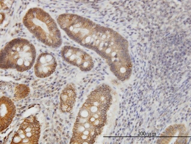 Monoclonal Anti-NPR2 antibody produced in mouse