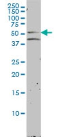 Monoclonal Anti-NR1H2 antibody produced in mouse