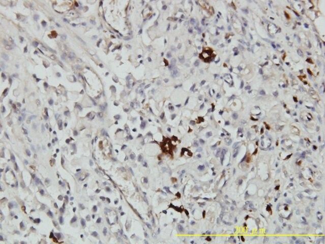 Monoclonal Anti-ORM1 antibody produced in mouse