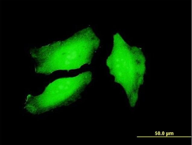 Monoclonal Anti-PADI4 antibody produced in mouse