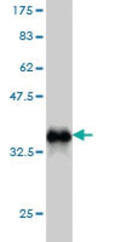 Monoclonal Anti-NOTCH3 antibody produced in mouse