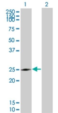 Monoclonal Anti-NQO2 antibody produced in mouse