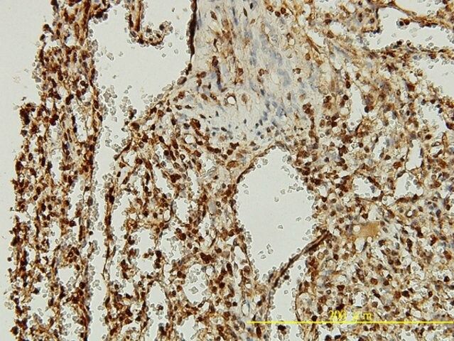 Monoclonal Anti-ORC2L antibody produced in mouse