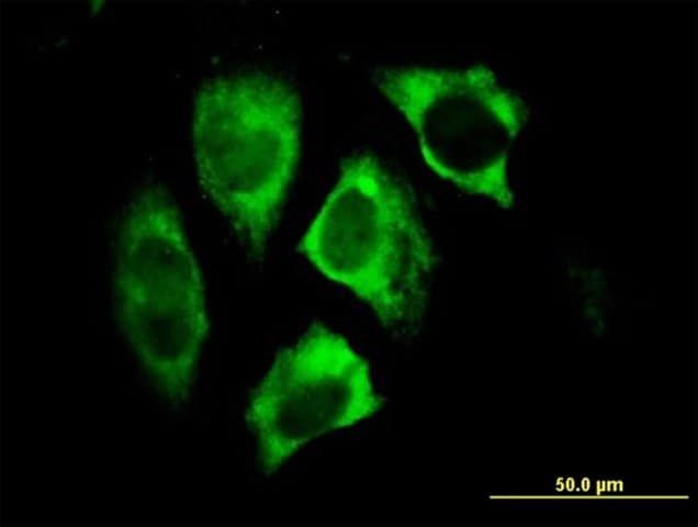 Monoclonal Anti-PARK2 antibody produced in mouse