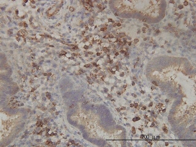 Monoclonal Anti-PANK2 antibody produced in mouse