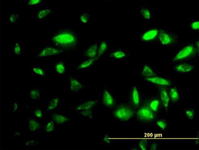 Monoclonal Anti-PEPD antibody produced in mouse