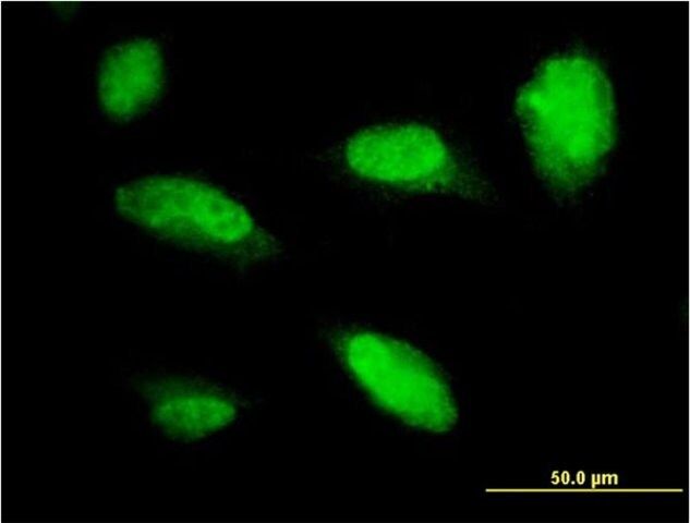 Monoclonal Anti-PHOX2A antibody produced in mouse