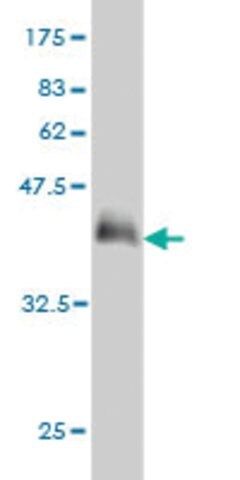 Monoclonal Anti-PHF21A antibody produced in mouse