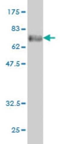 Monoclonal Anti-PHKG1 antibody produced in mouse