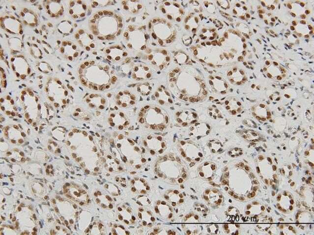 Monoclonal Anti-P15RS antibody produced in mouse