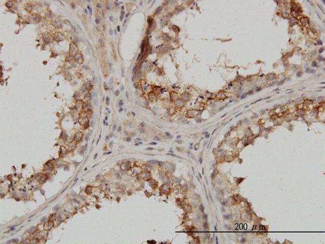 Monoclonal Anti-PSMB4 antibody produced in mouse