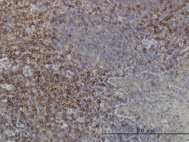 Monoclonal Anti-PRKCA antibody produced in mouse