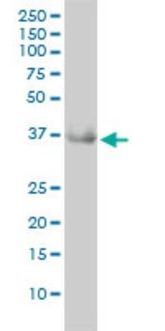 Monoclonal Anti-GRHPR antibody produced in mouse