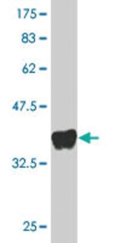 Monoclonal Anti-GPRC5D antibody produced in mouse