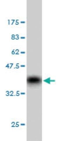 Monoclonal Anti-GRK6 antibody produced in mouse