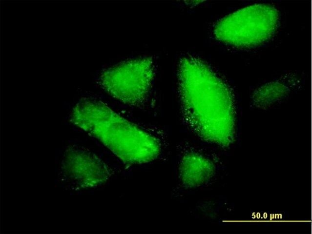 Monoclonal Anti-GSTZ1 antibody produced in mouse