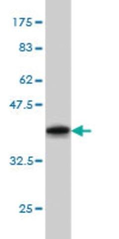 Monoclonal Anti-GRK1 antibody produced in mouse