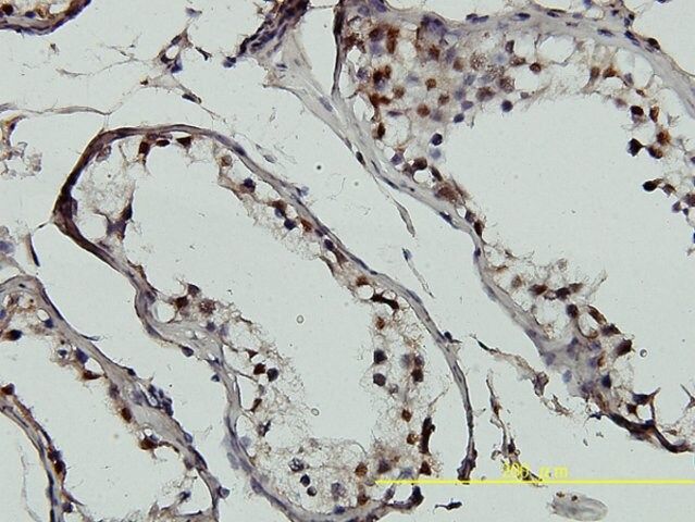 Monoclonal Anti-GTF2H1 antibody produced in mouse