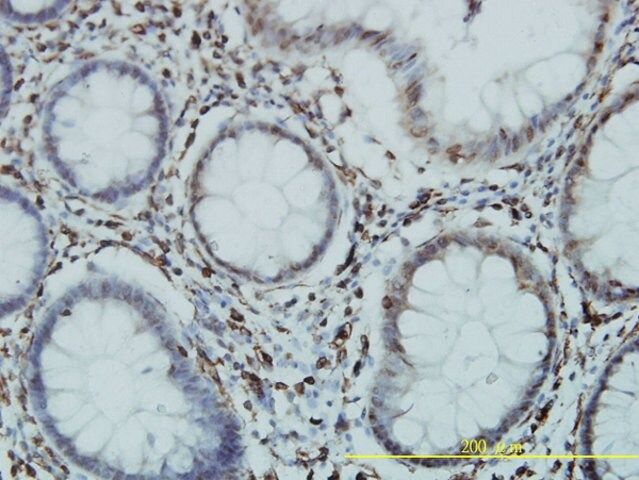 Monoclonal Anti-GTF3C2 antibody produced in mouse