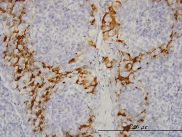 Monoclonal Anti-GSTA3 antibody produced in mouse