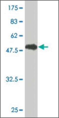 Monoclonal Anti-GSTT1 antibody produced in mouse