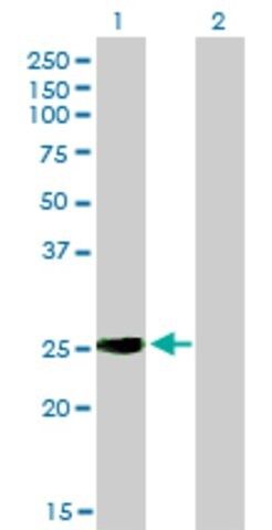 Monoclonal Anti-IGSF6 antibody produced in mouse