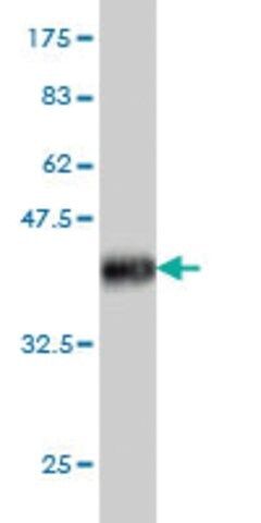 Monoclonal Anti-IL6R antibody produced in mouse