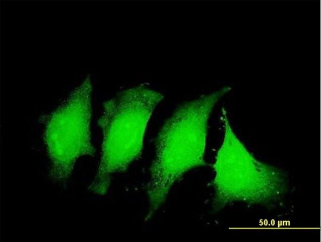 Monoclonal Anti-IL1B antibody produced in mouse