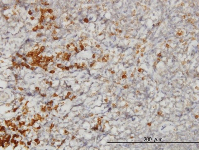 Monoclonal Anti-SSR1 antibody produced in mouse